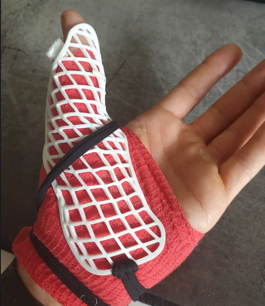 Nẹp cố định ngón cái 3D - Giải pháp bảo vệ khớp ngón tay hiệu quả - Image 2