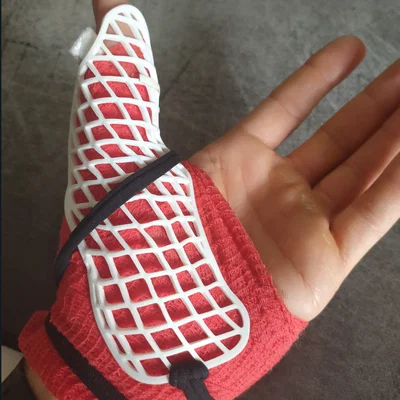 Nẹp cố định ngón cái 3D - Giải pháp bảo vệ khớp ngón tay hiệu quả