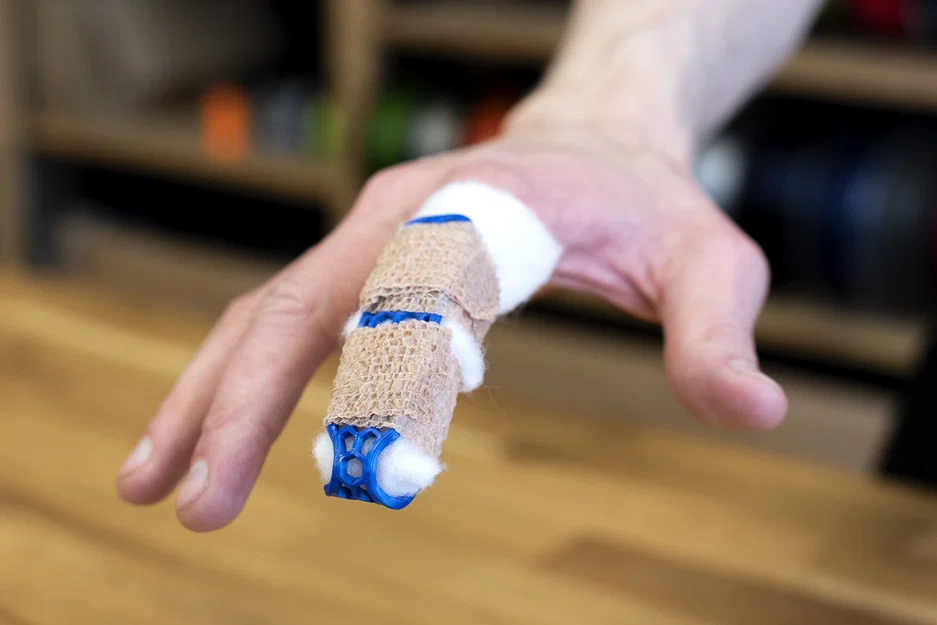 Nẹp ngón tay (splint) – Finger Brace - Image 1