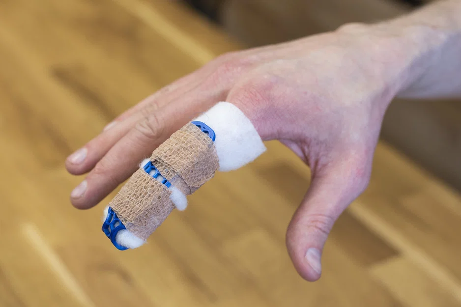 Nẹp ngón tay (splint) – Finger Brace - Image 4