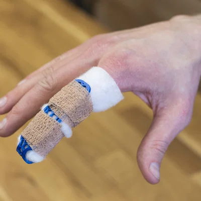 Nẹp ngón tay (splint) – Finger Brace