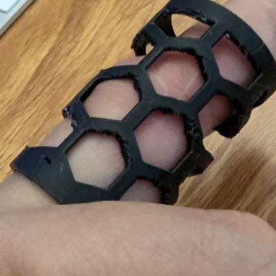 Nẹp cố định ngón tay (Finger Splint) - Thiết kế lưới 3D