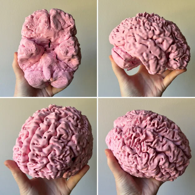 Bộ Não Người Thật Của Mình (My Genuine Human Brain) - Image 1