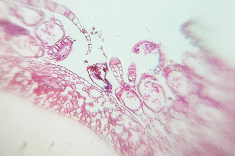 Mobile Microscope – Kính hiển vi gắn smartphone in 3D siêu tiết kiệm - Image 7