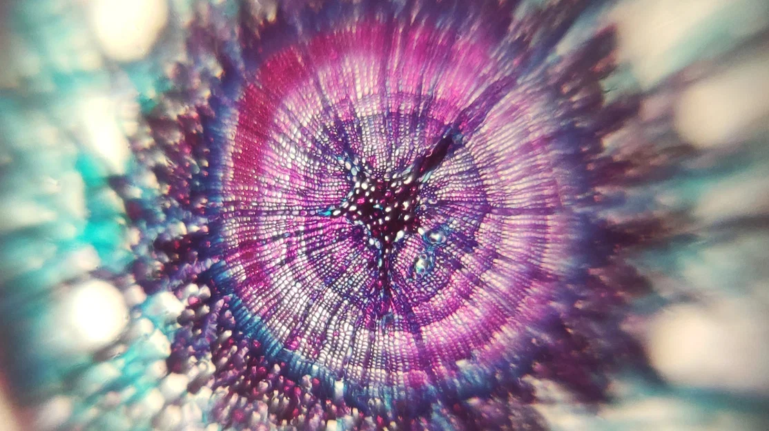 Mobile Microscope – Kính hiển vi gắn smartphone in 3D siêu tiết kiệm - Image 9