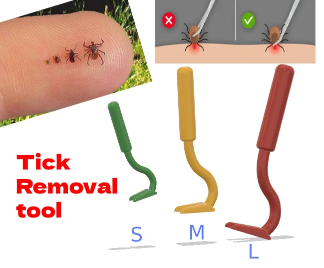 Dụng cụ hỗ trợ lấy ve chó, bọ chét (Tick Removal Tool) 3 kích thước - Image 1