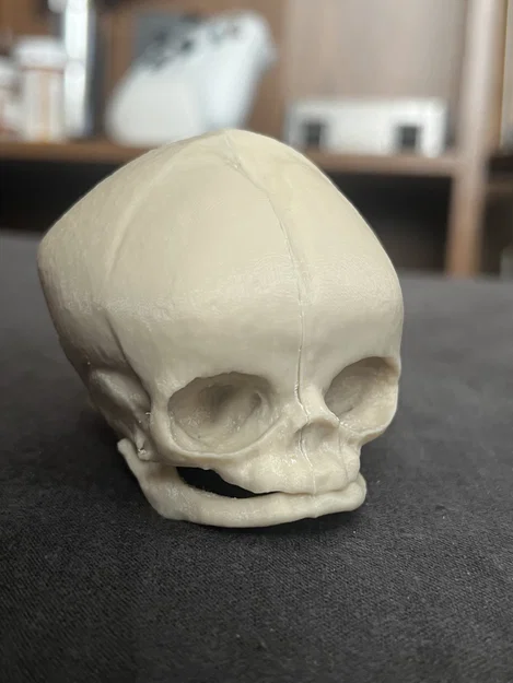 Sọ Em Bé Sơ Sinh (Newborn Baby Skull) - Image 1