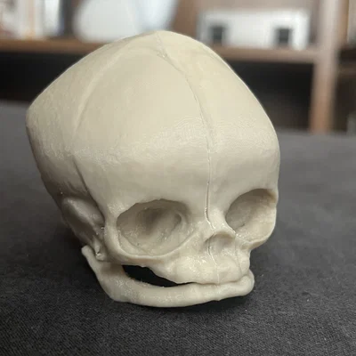 Sọ Em Bé Sơ Sinh (Newborn Baby Skull)