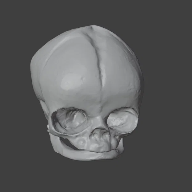 Sọ Em Bé Sơ Sinh (Newborn Baby Skull) - Image 2