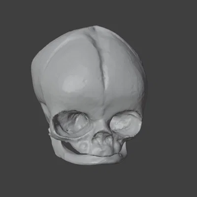 Sọ Em Bé Sơ Sinh (Newborn Baby Skull)