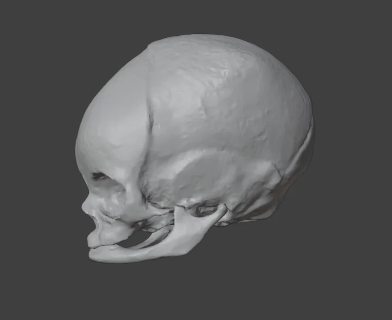 Sọ Em Bé Sơ Sinh (Newborn Baby Skull) - Image 3