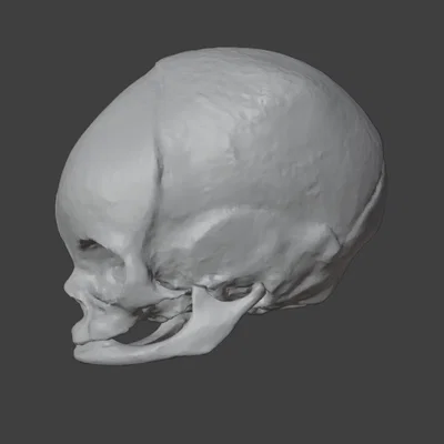 Sọ Em Bé Sơ Sinh (Newborn Baby Skull)
