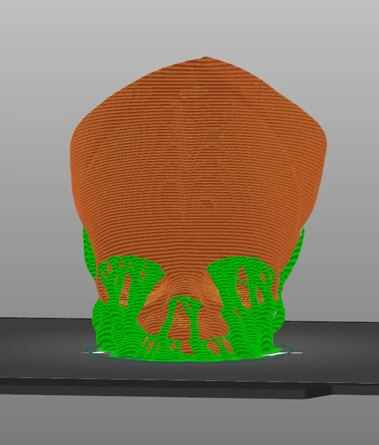 Sọ Em Bé Sơ Sinh (Newborn Baby Skull) - Image 4