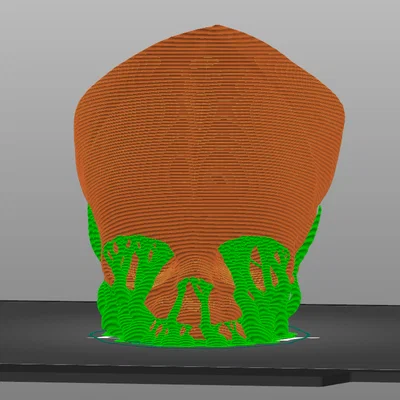 Sọ Em Bé Sơ Sinh (Newborn Baby Skull)