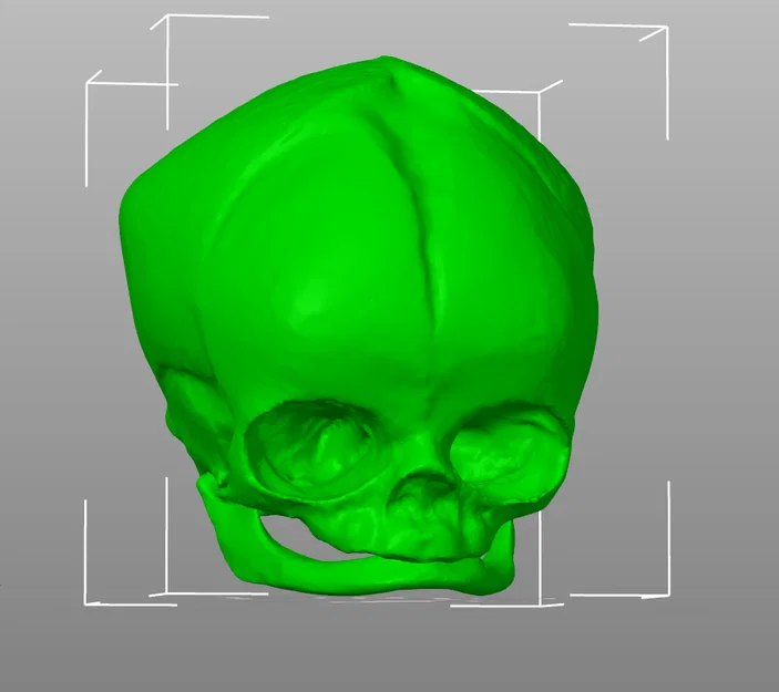 Sọ Em Bé Sơ Sinh (Newborn Baby Skull) - Image 5