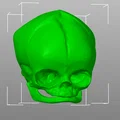 Sọ Em Bé Sơ Sinh (Newborn Baby Skull) - Thumbnail 5