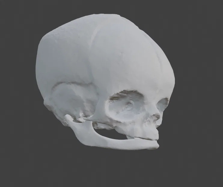 Sọ Em Bé Sơ Sinh (Newborn Baby Skull) - Image 6