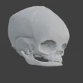 Sọ Em Bé Sơ Sinh (Newborn Baby Skull) - Thumbnail 6