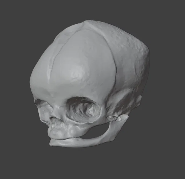 Sọ Em Bé Sơ Sinh (Newborn Baby Skull) - Image 7