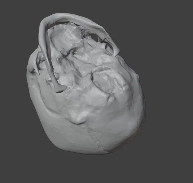 Sọ Em Bé Sơ Sinh (Newborn Baby Skull) - Image 8
