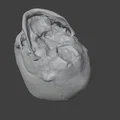 Sọ Em Bé Sơ Sinh (Newborn Baby Skull) - Thumbnail 8