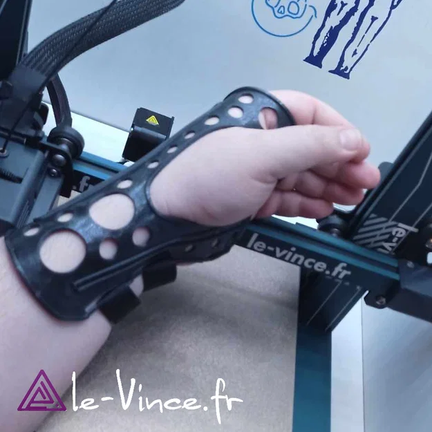 Nẹp cổ tay hỗ trợ in 3D tùy chỉnh (Wrist Orthosis) - Image 1