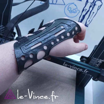 Nẹp cổ tay hỗ trợ in 3D tùy chỉnh (Wrist Orthosis)