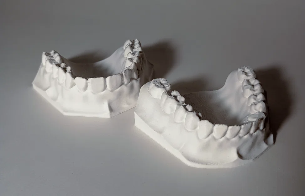 Mẫu Nha Khoa - Bộ răng hàm trên và hàm dưới - Image 2