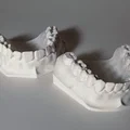 Mẫu Nha Khoa - Bộ răng hàm trên và hàm dưới - Thumbnail 2