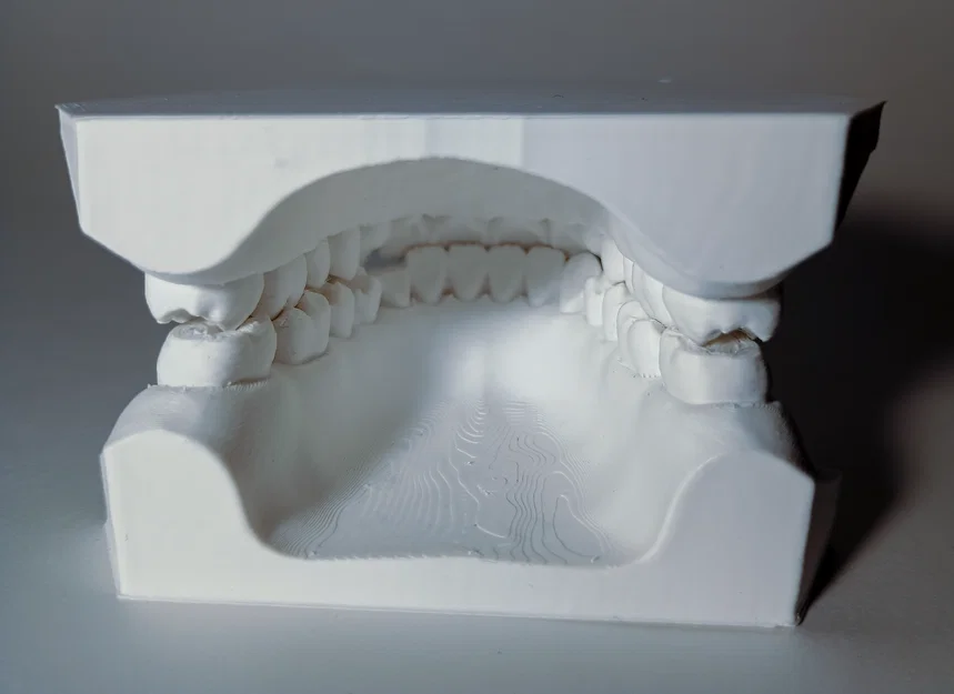 Mẫu Nha Khoa - Bộ răng hàm trên và hàm dưới - Image 3