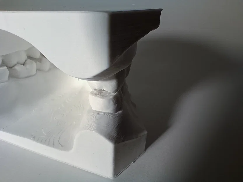 Mẫu Nha Khoa - Bộ răng hàm trên và hàm dưới - Image 4