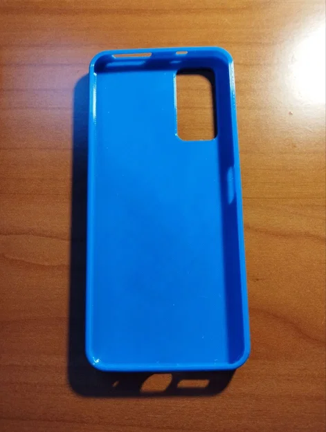 Ốp Xiaomi Redmi Note 11 nút âm lượng cải tiến (kèm bản Genshin Furina) - Image 6