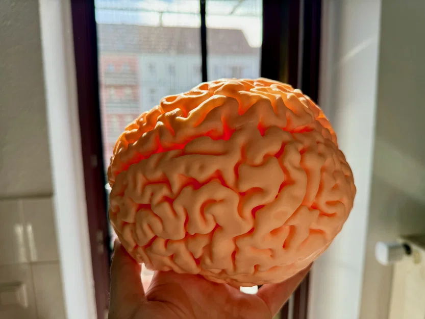 MRI Brain Scan – Mô hình quét MRI não bộ - Image 2