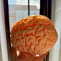 MRI Brain Scan – Mô hình quét MRI não bộ - Thumbnail 2