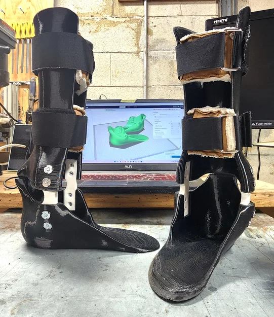 Nẹp chân FIDIM 3 AFO (Leg Braces) in 3D - Image 1
