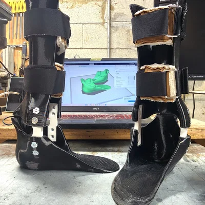 Nẹp chân FIDIM 3 AFO (Leg Braces) in 3D