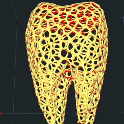 Mô hình răng trang trí phong cách Voronoi in 3D ấn tượng