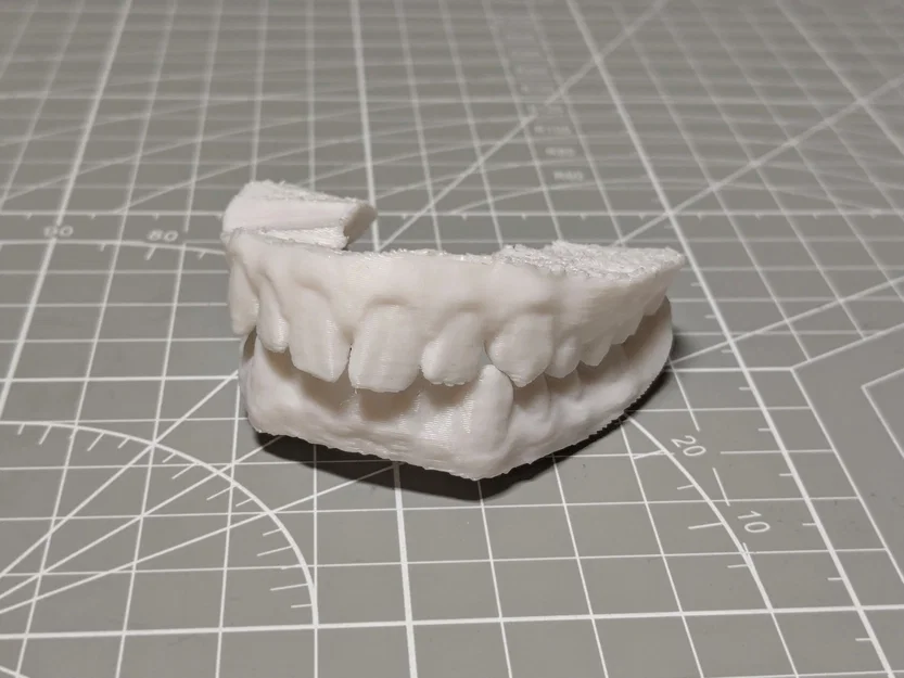 Bản scan 3D thật của răng mình - Image 1