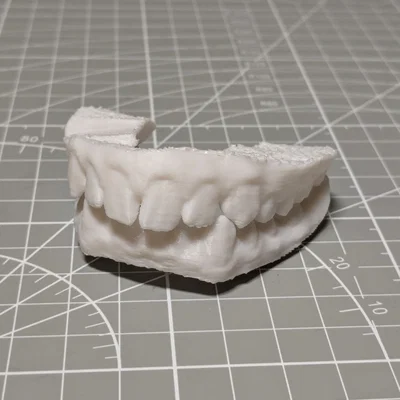 Bản scan 3D thật của răng mình