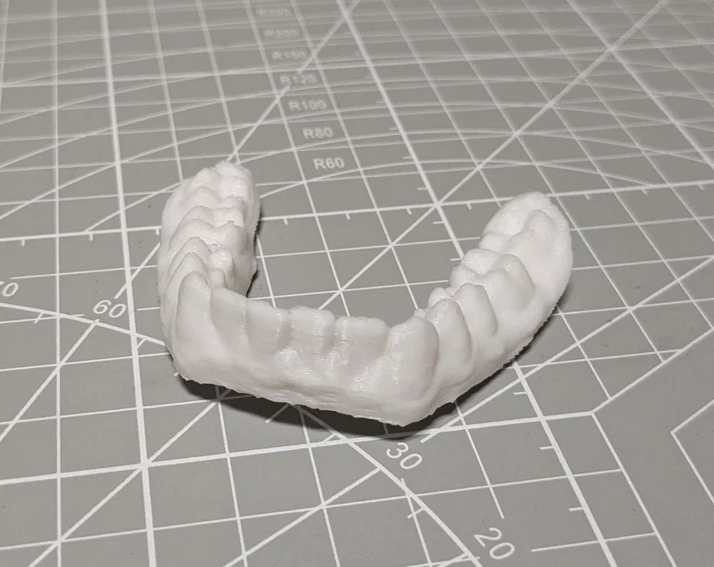 Bản scan 3D thật của răng mình - Image 2