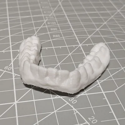 Bản scan 3D thật của răng mình