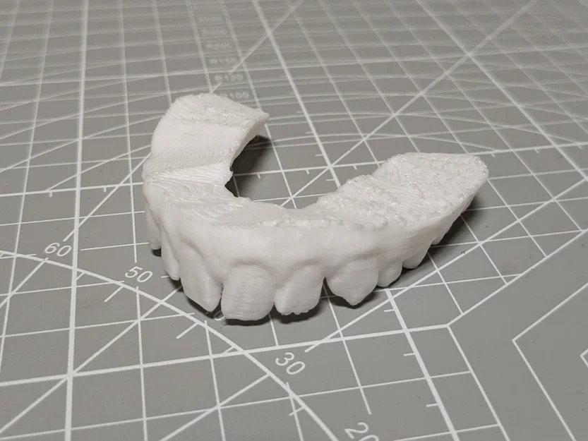 Bản scan 3D thật của răng mình - Image 3