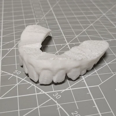 Bản scan 3D thật của răng mình