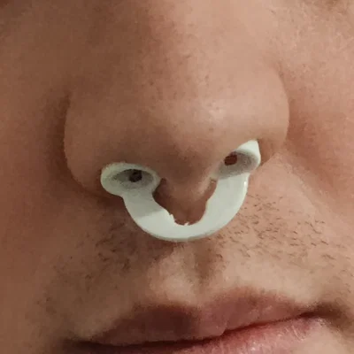 Anti Snoring Buds – Buds chống ngáy in 3D