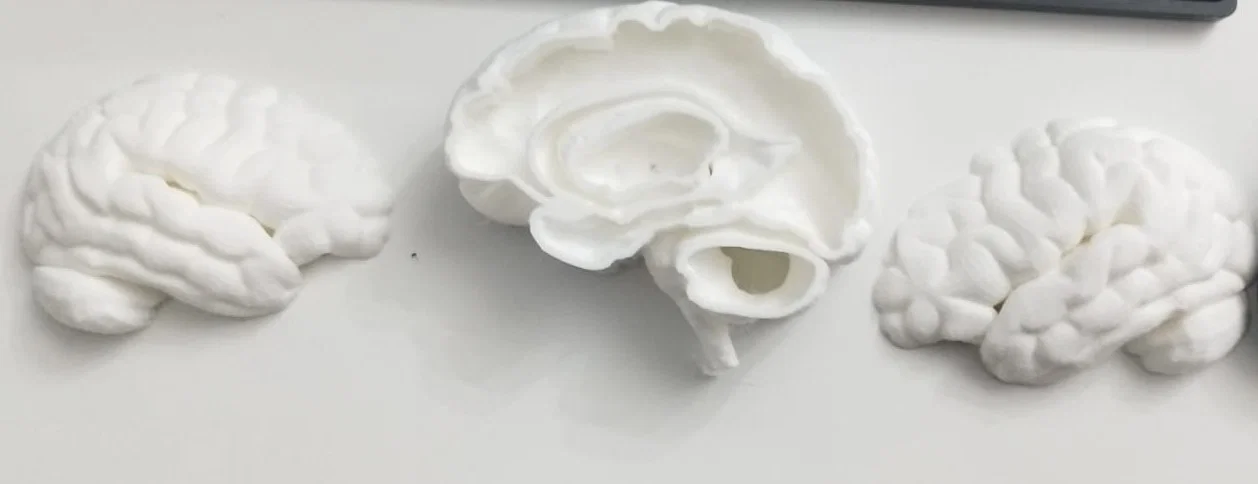 Mô hình não bộ rỗng (Hollow Brain) in 3D kết hợp đèn LED trang trí - Image 1