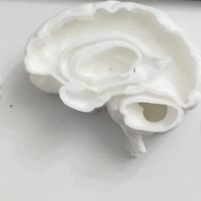Mô hình não bộ rỗng (Hollow Brain) in 3D kết hợp đèn LED trang trí