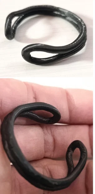 Thiết bị kéo bao quy đầu dạng vòng (ring) – Foreskin retraction device - Image 1