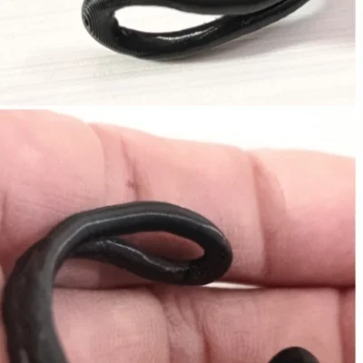 Thiết bị kéo bao quy đầu dạng vòng (ring) – Foreskin retraction device
