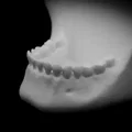 Tô Xương Hàm Người (Pre Supported) - Thumbnail 1