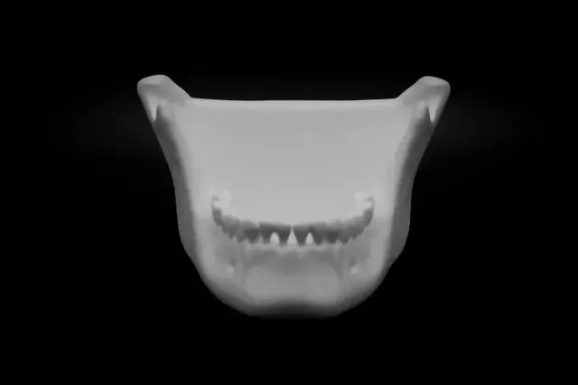 Tô Xương Hàm Người (Pre Supported) - Image 2